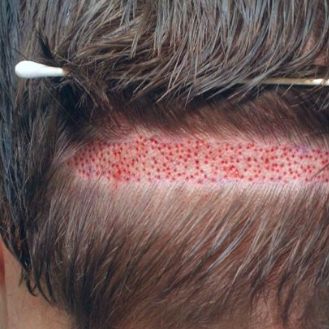 HairSpecialistinLahore